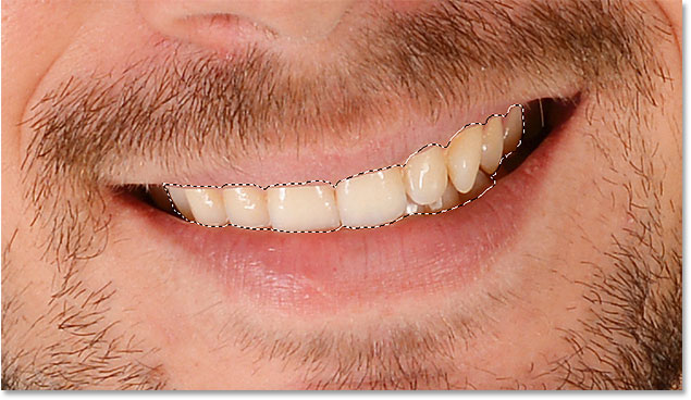 Drawing a selection outline around the teeth with the Lasso Tool.