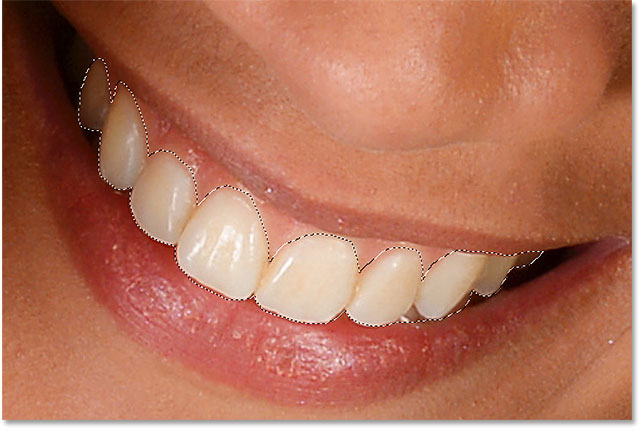Selecting the woman's teeth with the Lasso Tool.