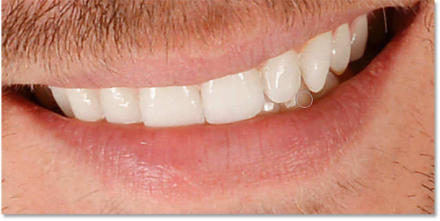 Painting over specific teeth with a lower opacity brush.