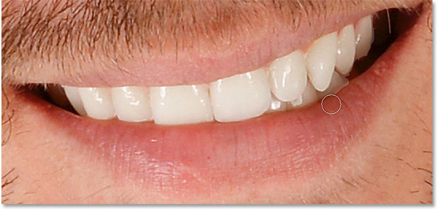 Cleaning up the area below the teeth.