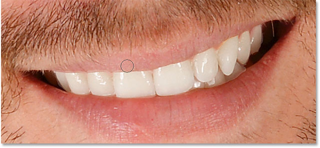 Painting on the layer mask with black along the top of the teeth.