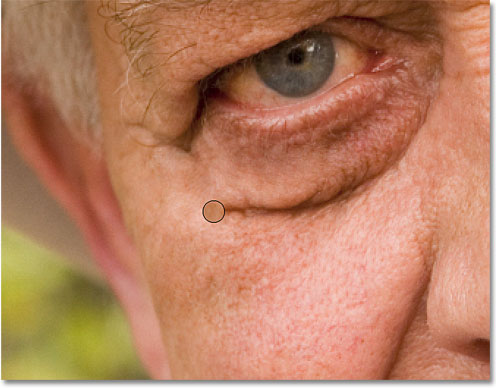 Removing the larger wrinkle under his eye with a series of short strokes. Image © 2010 Photoshop Essentials.com