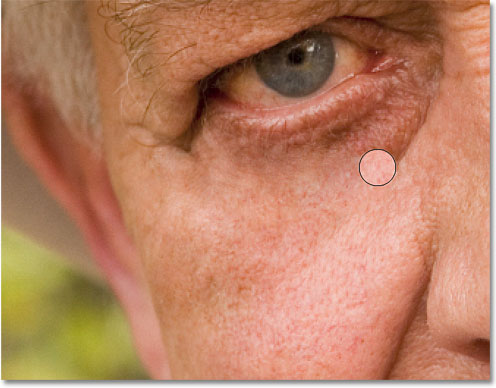 Continuing to remove the larger wrinkle under the man's eye with the Healing Brush. Image © 2010 Photoshop Essentials.com