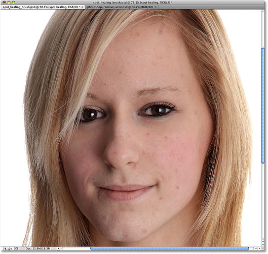 The original state of the photo with pimples on the girl's face. Image © 2010 Photoshop Essentials.com