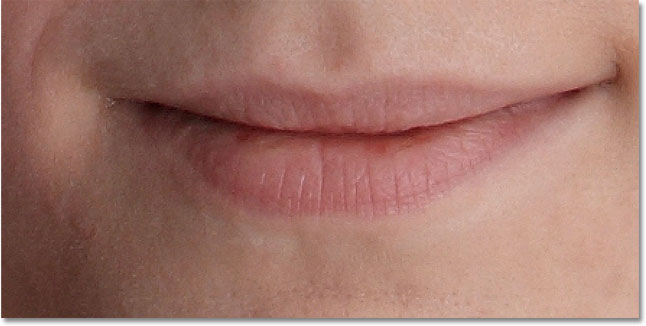 The row of pimples below the girl's mouth has been removed with the Spot Healing Brush in Photoshop. Image © 2010 Photoshop Essentials.com