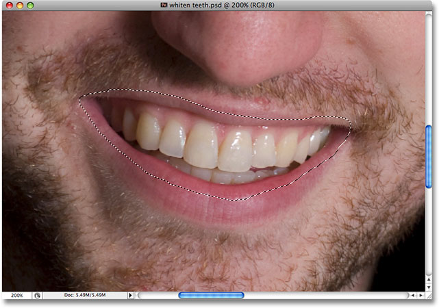 Использование Lasso Tool в Photoshop, чтобы выбрать область вокруг зубов человека. Image © 2008 Photoshop Essentials.com.